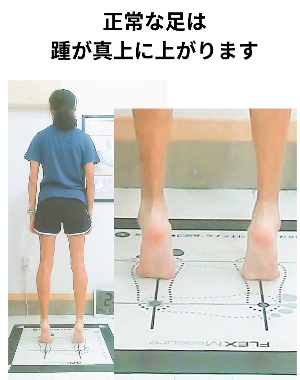 陸上部・正常な足