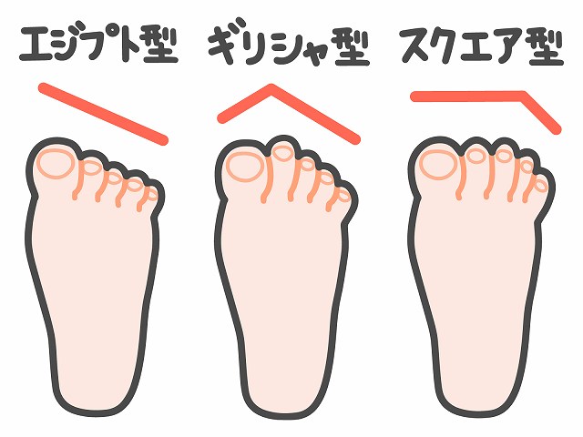 親指がシューズに当たる理由と解決方法１