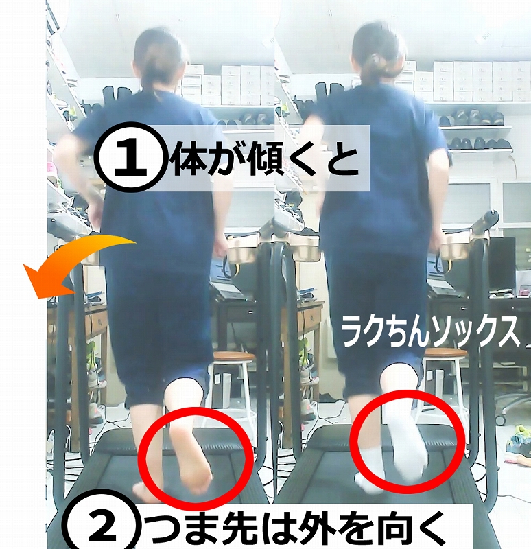 ランニングで跳ね上げた足のつま先が外を向くのはなぜ?