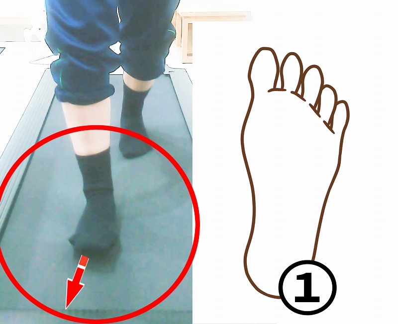 つま先が外を向いた歩き出しの様子