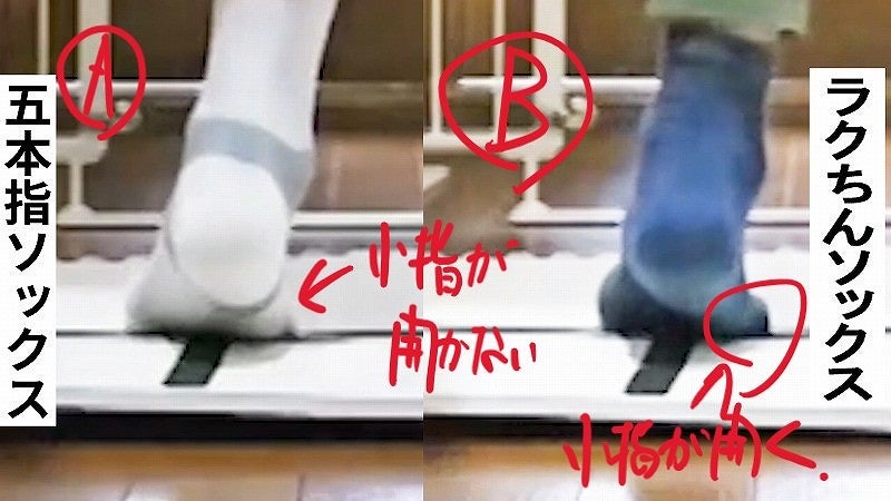 五本指ソックス足に悪い理由