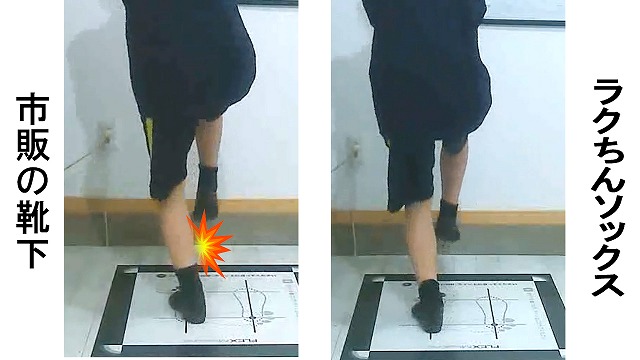 後脛骨筋炎・シンスプリントの原因はコレ