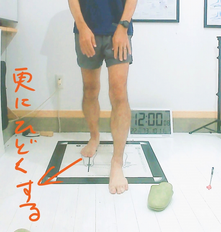 トゥーアウトを自分で治そうとしている画像