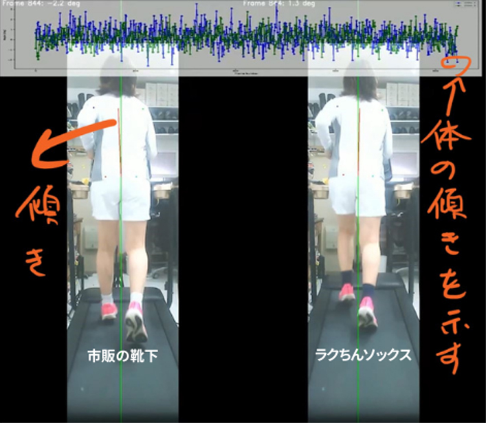歩くときにグラつく原因