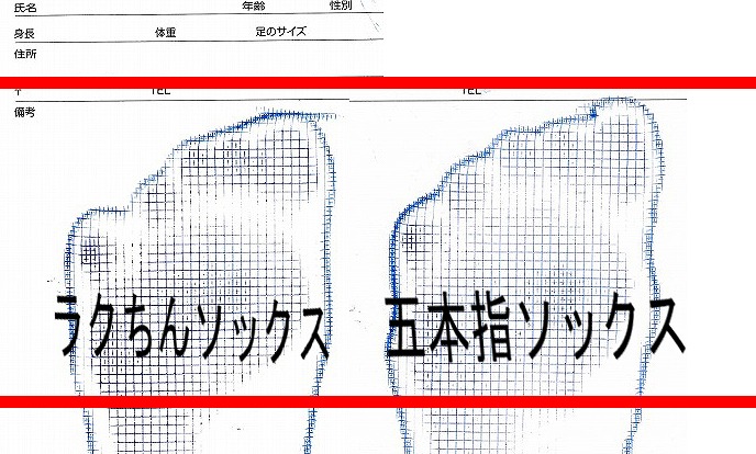 ランニングに五本指ソックスを勧めない理由