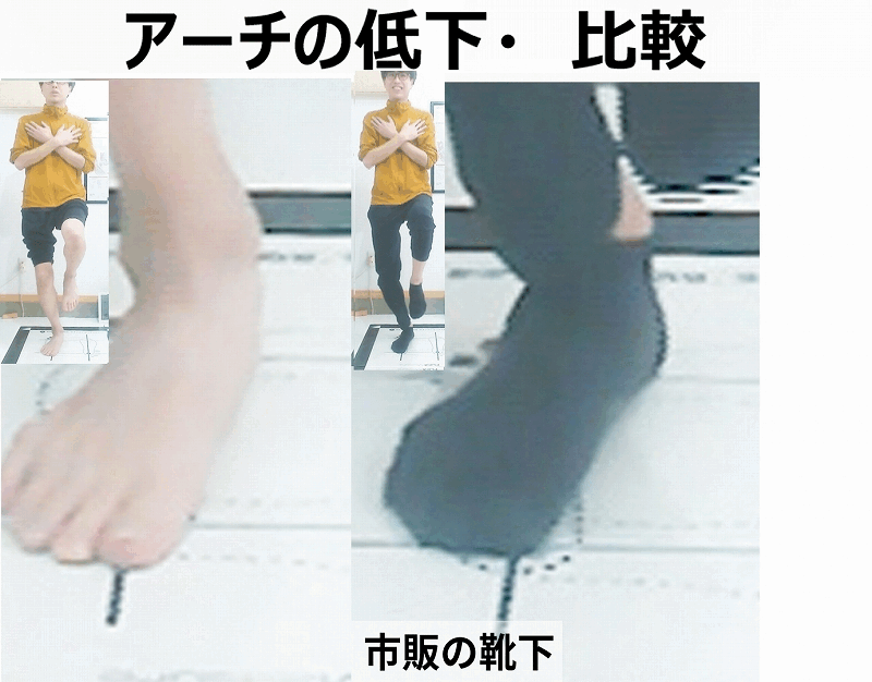 アーチが保たれている状態 外くるぶしと シューズに余裕があるアーチが低下している状態 外くるぶしが シューズに近づく  アーチが保たれている状態 外くるぶしと シューズに余裕がある  ※