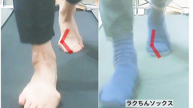 "素足とラクちんソックス着用時における足指の向きと使われ方の比較"