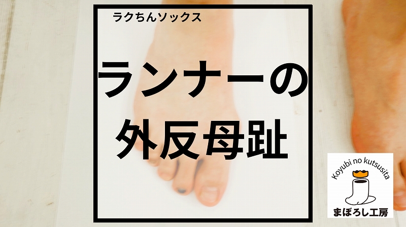 Q．最近ランニングを始めましたが外反母趾が痛みます。