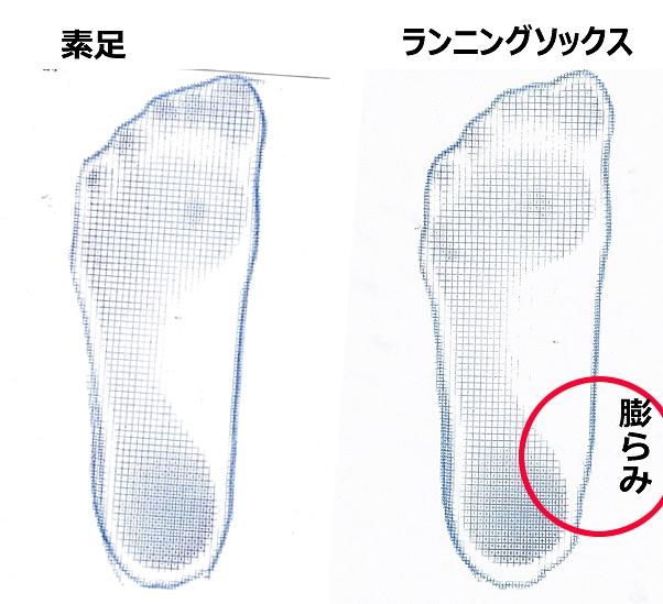 症例002│ランニングソックス着用による足底接地形状の変化