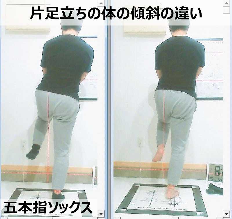 体の外傾と母趾への負担の関係を示す比較