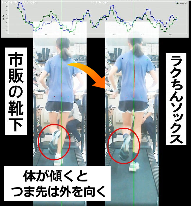 ランニングで跳ね上げた足のつま先が外を向くのはなぜ？