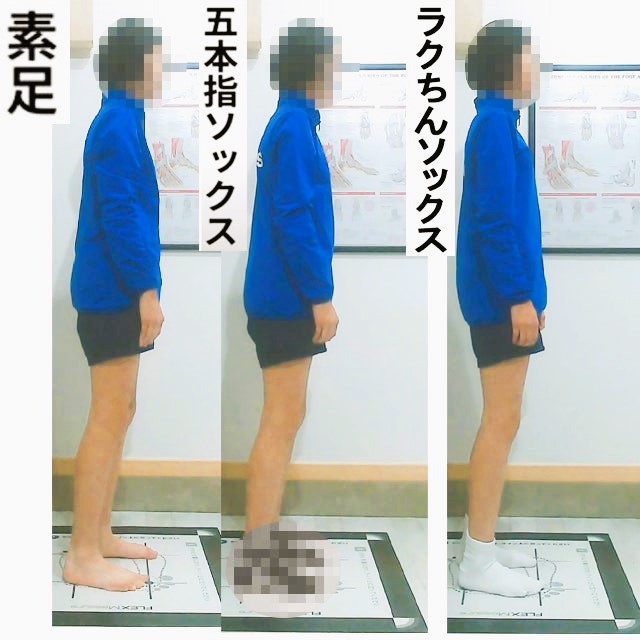 五本指ソックスが足に悪い理由
