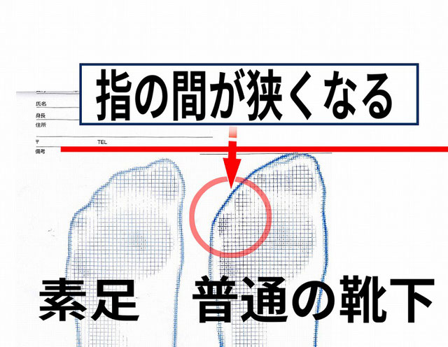 内反小趾、寝指の原因
