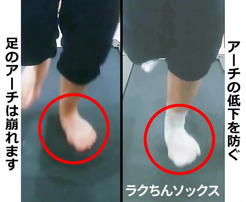 アーチの低下はなぜ起きるか？説明