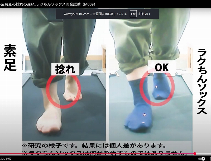 素足と着用時の歩行で親指のねじれ回数を比較したキャプチャ。
