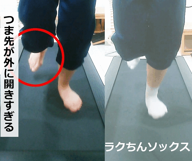 “つま先の向き”に悩む方へ│つま先が開く原因と、今日からできる対策