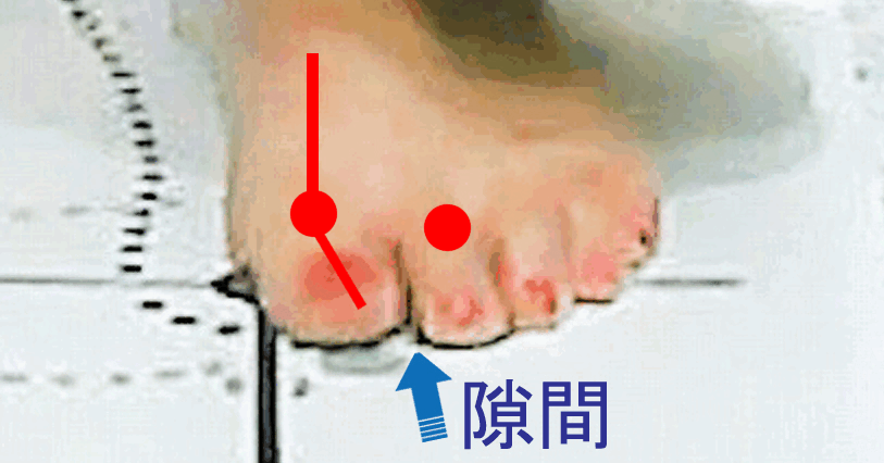 外反母趾になる理由