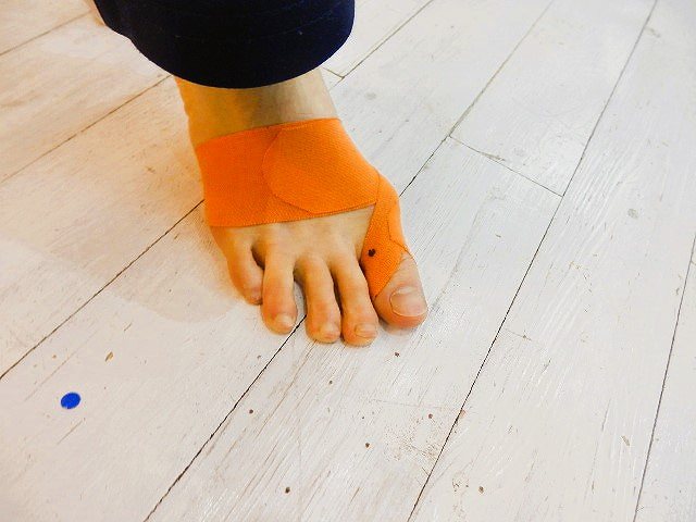 "外反母趾の痛みを軽減するためにランニング前にテーピングを行っている様子"