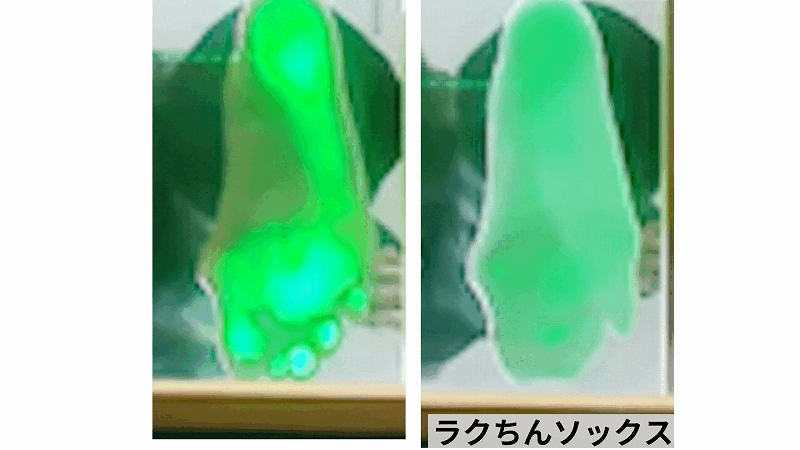 外反母趾の治し方