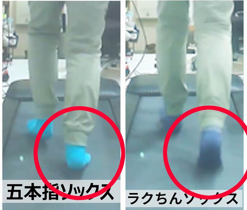 足裏の圧が集中してマメができやすい部位の比較写真