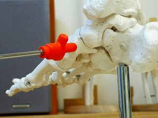 足の内側の出っ張り（舟状骨）はなぜ痛くなる？│ランナー・学生に多い症状
