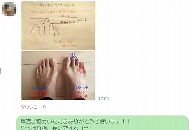 外反母趾に五本指ソックスは効果がある?