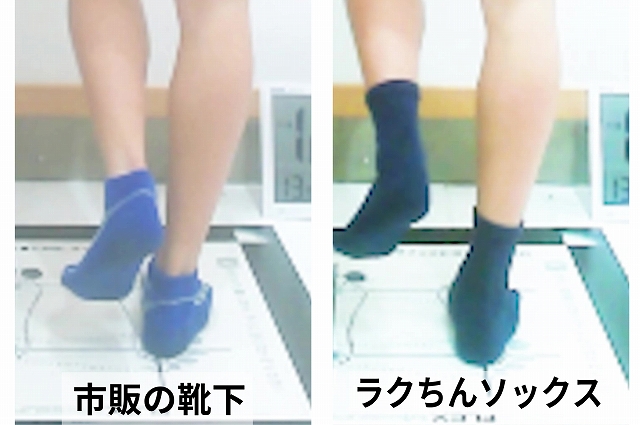 靴下の違いによる足部の回旋と指の見え方の変化