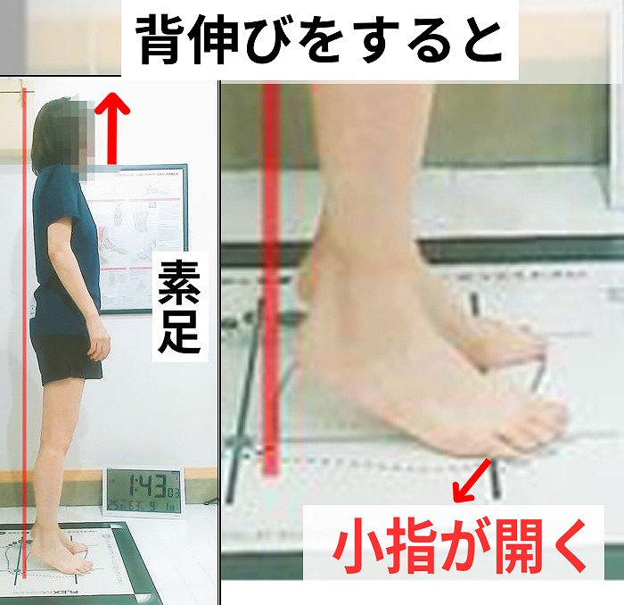 横から見た靴下の違いによるヒールリフトの違い