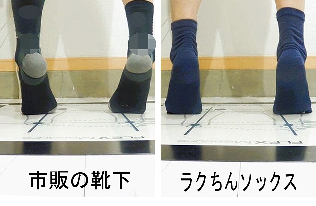 足裏の圧が集中してマメができやすい部位の比較写真