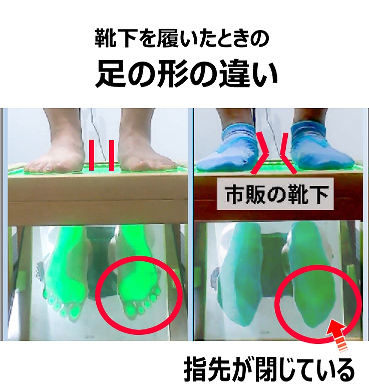 なぜ？普通の靴下を履くとアーチが落ちたのか？
