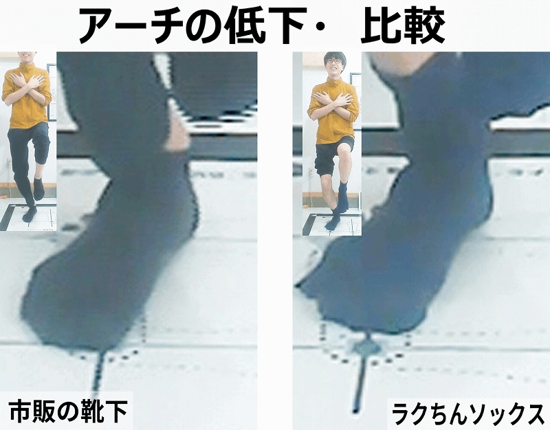 アーチが低下している状態 外くるぶしが シューズに近づく  アーチが保たれている状態 外くるぶしと シューズに余裕がある