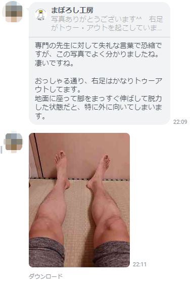 上向きに寝ると片方だけつま先が外を向く写真