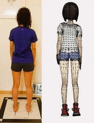 ストレッチをしても治らない