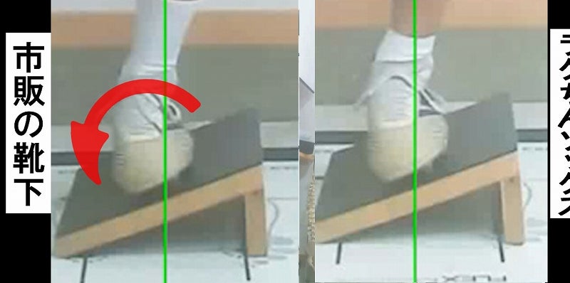 内くるぶし 下 痛い理由に答えます
