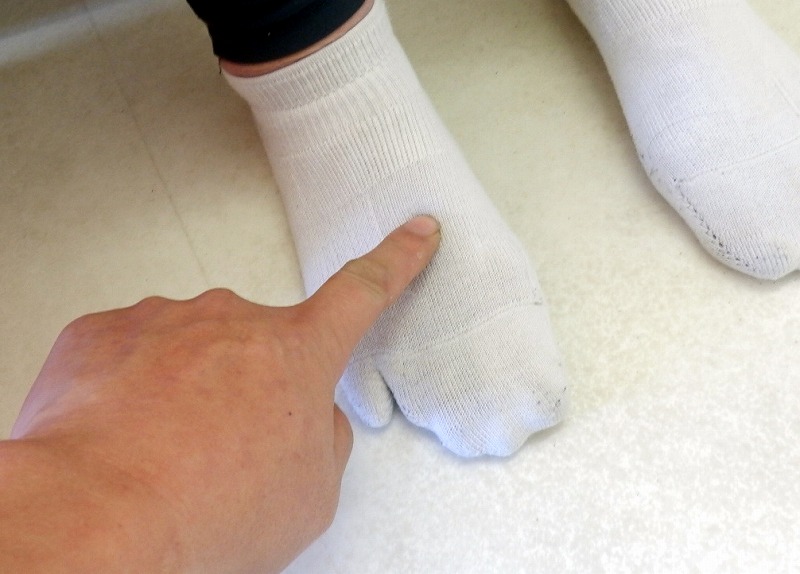 ラクちんソックスで足指の広がりを抑えた様子