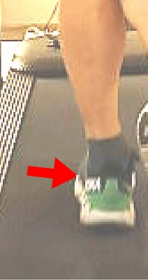Q.外くるぶしの下の所にシューズが当たって痛みます。その原因と改善のヒント