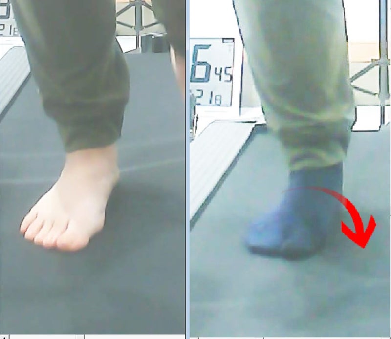 素足と足袋型ソックスの歩行比較。足袋型ソックスでは、歩き出しの時点で親指への負担が増えるケースが見られた。