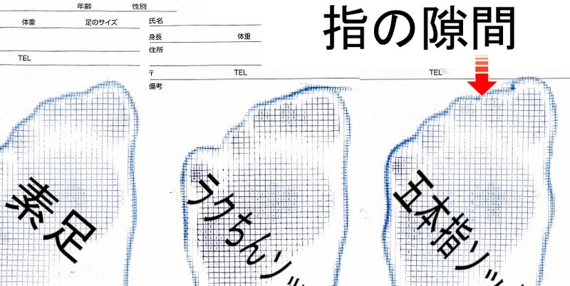 足の小指が開かないとどうなる?