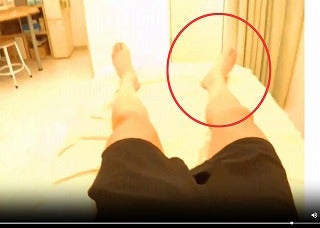 足のつま先が片方だけ外を向く悩み