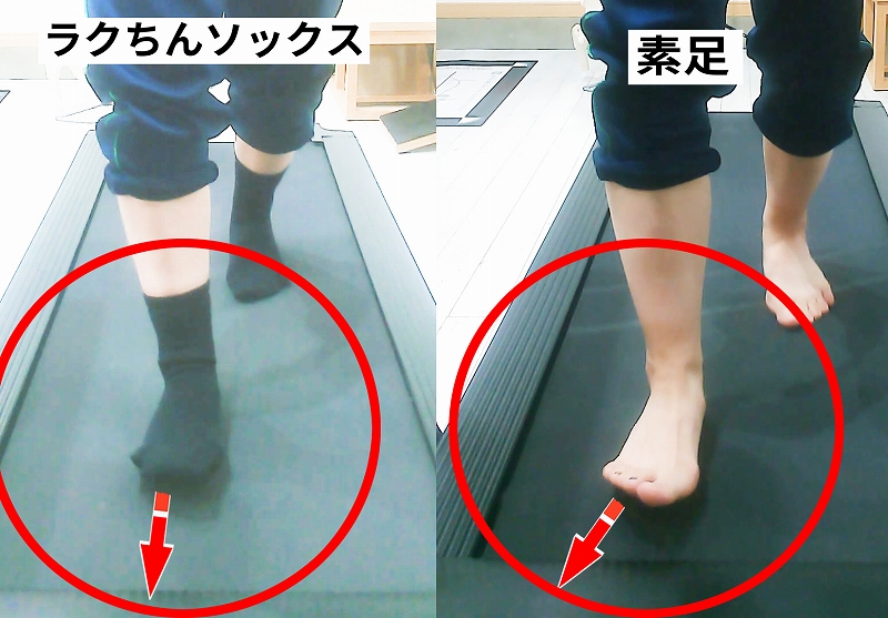 歩いているときにつま先が外を向いているのが気になります│勝手に決まるつま先の向き