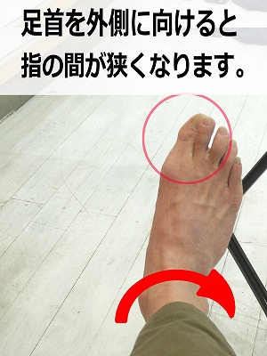 外反母趾は、どこから始まるのか