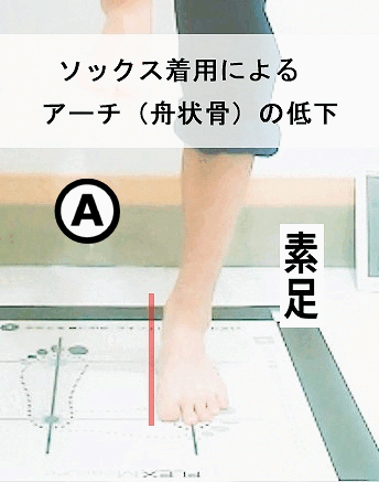 外反母趾に五本指ソックスは効果がある?