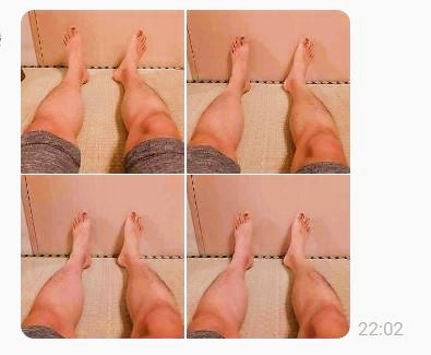 足の爪先が寝ると外を向くときの改善方法
