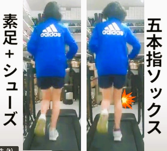 五本指ソックスが足に悪い理由