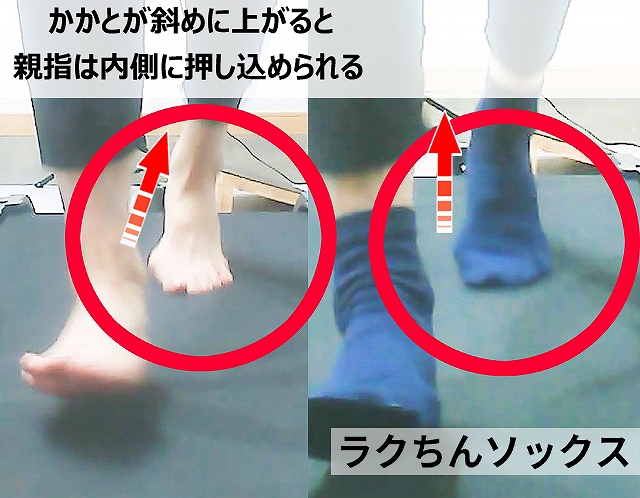 ラクちんソックスを着用した状態で歩く足元の様子。