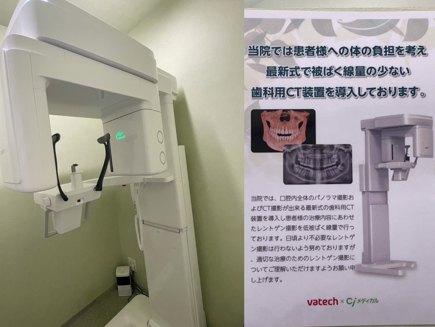 最新式の歯科用CTを導入しました！