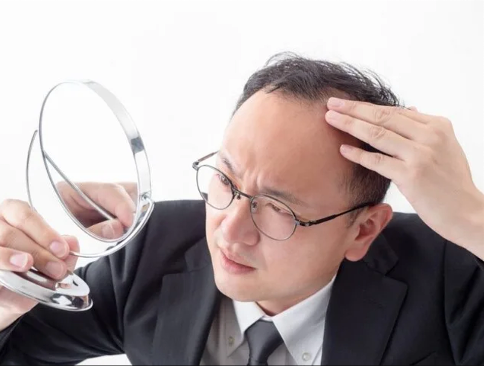 【おもしろブログ】AGA治療勝負！毛生え薬と全身脱毛の攻防戦！