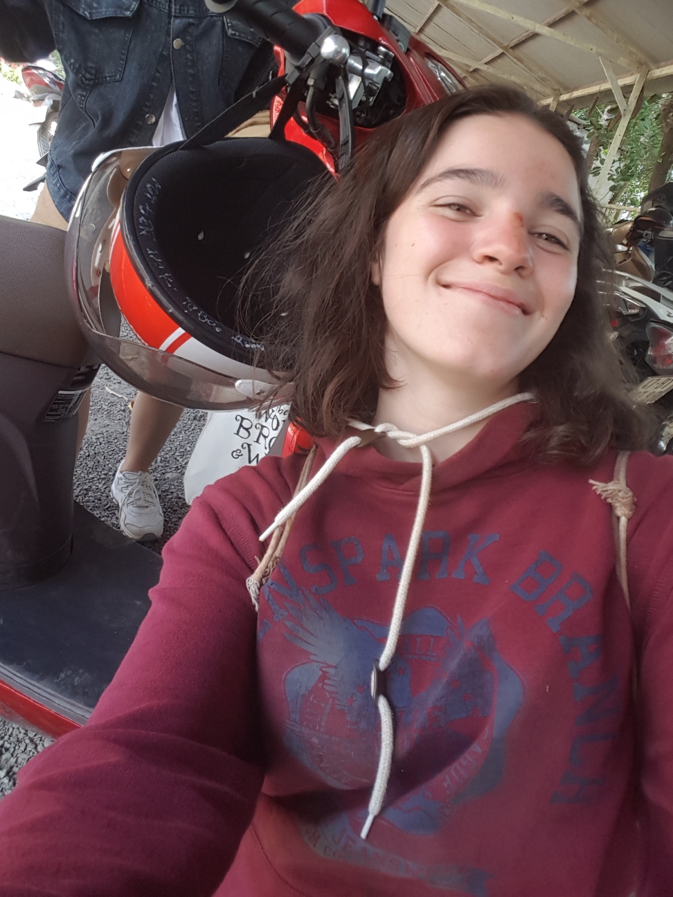 Selfie after first scooter accident