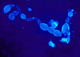 Bacillus Subtilis DSM 21097: tötet pathogene Bakterien und unterstützt gesunde Mikroorganismen