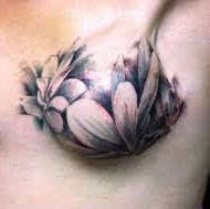 Masquage de Cicatrice par Tatouage artistique suite à reconstruction mammectomie partielle